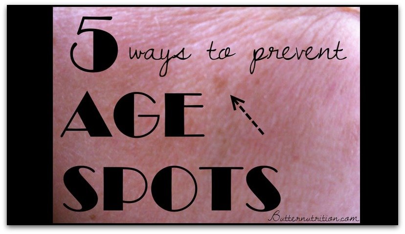 5 ways to prevent age spots. Good to know!