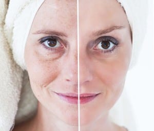 pterostilbene for anti aging